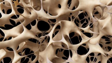 Halk arasında kemik erimesi olarak bilinen osteoporozu önlemek için sağlıklı beslenme ve düzenli fiziksel aktivitenin önemli olduğu belirtiliyor.